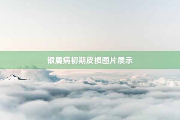 银屑病初期皮损图片展示
